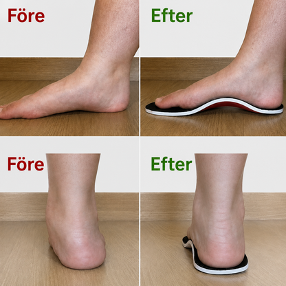 Kynflex FlexArch | Stöd för fotvalvet, steg för steg