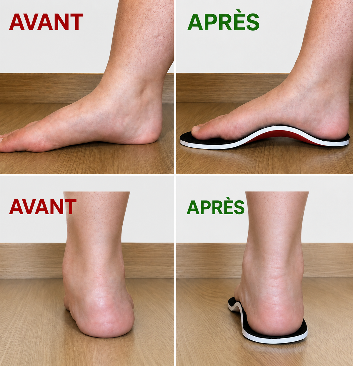 FlexArch — Un soutien pour la voûte plantaire, pas à pas.